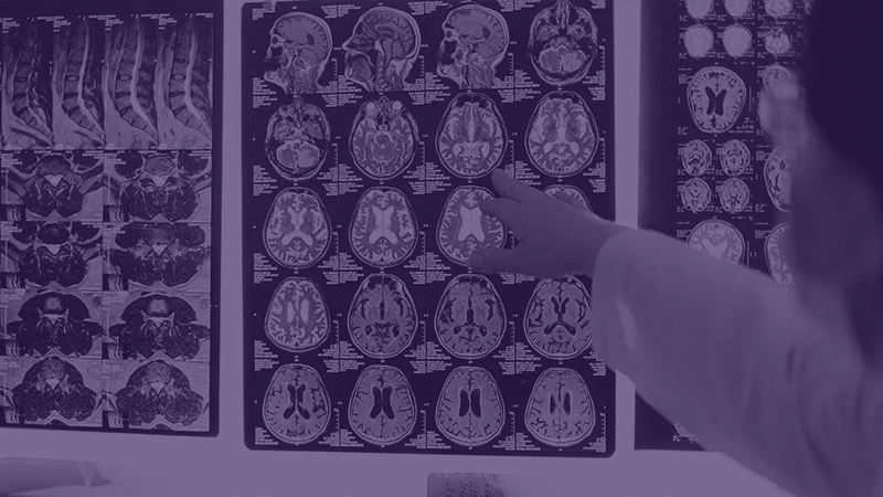 Masterclass Neurologie